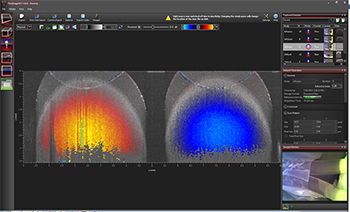 OCT Doppler Imaging Screen Shot