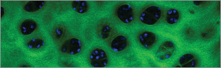 Multiphoton Second Harmonic Generation