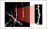 Multiphoton Microscopes